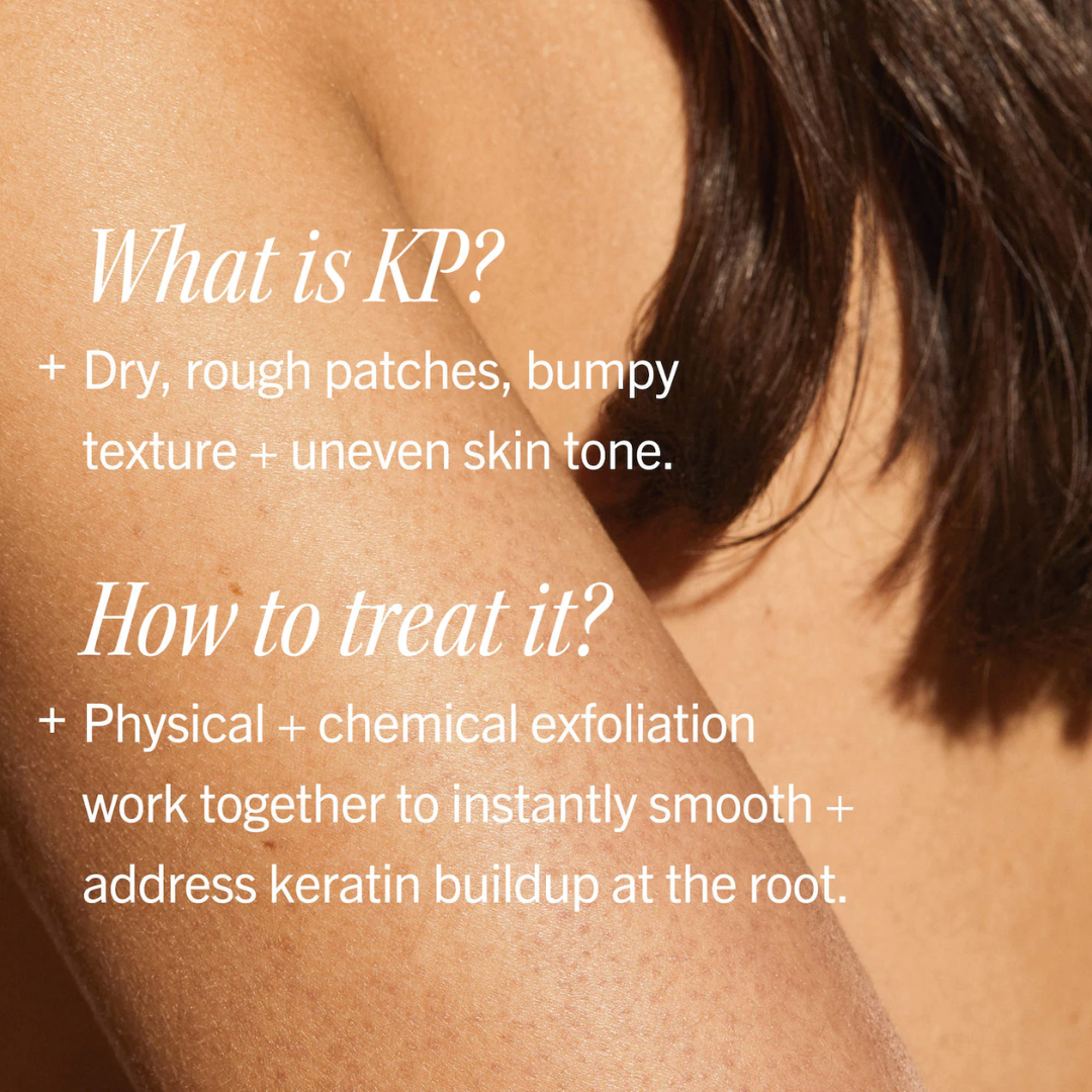First Aid Beauty  KP Bump Eraser Body Scrub with 10% AHA – Body Exfoliant for Keratosis Pilaris